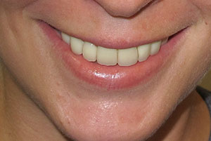 Dental Office in North Bellmore