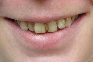 Best Dentist in North Bellmore